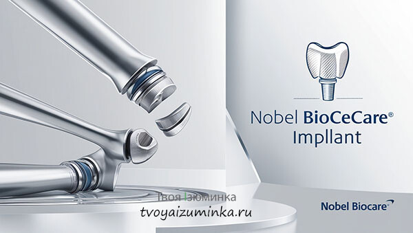 Пять преимуществ имплантов Nobel, за которые стоит заплатить